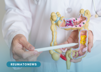 Câncer colorretal é a principal causa de morte por câncer em jovens nos EUA