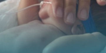 SUS passa a oferecer imunobiológico para proteger bebês e crianças com comorbidades contra a bronquiolite