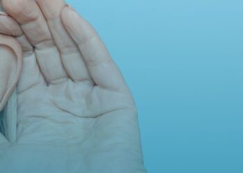 Tecnologia de implante auditivo para perda auditiva é tema de consulta pública da Comissão Nacional de Incorporação de Tecnologias no SUS