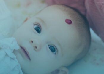 Conitec abre consulta pública para atualização do PCDT de Hemangioma Infantil