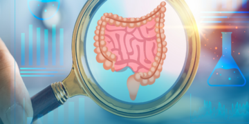 Câncer colorretal cresce 7,6% ao ano entre adultos jovens no Brasil, aponta A.C.Camargo