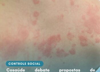 Cosaúde analisa contribuições e debate propostas de incorporação de novas tecnologias para o tratamento da dermatite atópica, fibrilação atrial e câncer de próstata