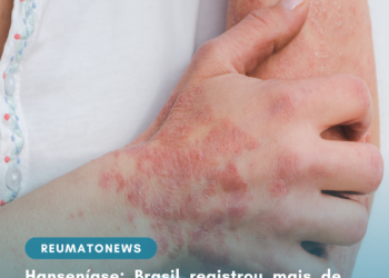 Hanseníase: Brasil registrou mais de 300 mil casos da doença em dez anos