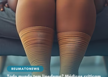 Todo mundo tem lipedema? Médicos criticam o excesso de diagnósticos e a venda de falsas soluções