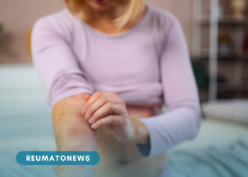 Coceira: pesquisadores descobrem mecanismo no cérebro que interrompe a sensação