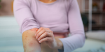 Coceira: pesquisadores descobrem mecanismo no cérebro que interrompe a sensação