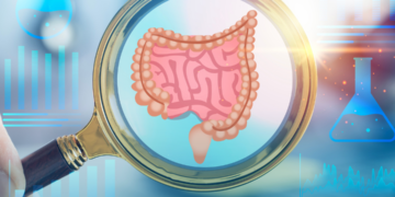 CÂNCER COLORRETAL CRESCE 7,6% AO ANO ENTRE ADULTOS JOVENS NO BRASIL, APONTA A.C.CAMARGO