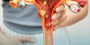 Clínica Elsimar Coutinho alerta no Março Lilás: câncer do colo do útero ainda causa mais de 7 mil mortes por ano no Brasil