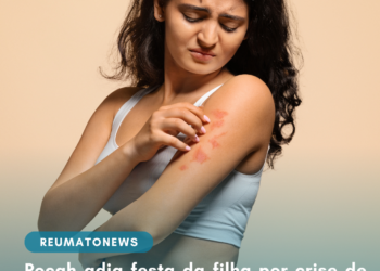 Pocah adia festa da filha por crise de psoríase da menina: ‘Não conseguia andar’