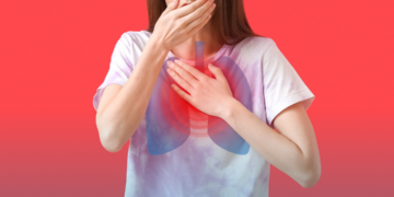 Tuberculose: pacientes com doenças reumáticas têm risco até 10 vezes maior