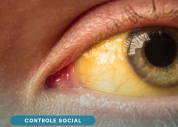 Conitec abre novas consultas públicas sobre tratamentos e protocolos clínicos no SUS