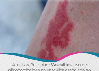 EULAR 2026: Atualizações sobre Vasculites: uso de glicocorticoides na vasculite associada ao ANCA (AAV) e na arterite de células gigantes (ACG)