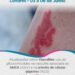 EULAR 2026: Atualizações sobre Vasculites: uso de glicocorticoides na vasculite associada ao ANCA (AAV) e na arterite de células gigantes (ACG)
