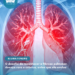 O desafio de reconhecer a fibrose pulmonar, doença rara e crônica, antes que ela evolua