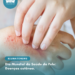 Dia Mundial da Saúde da Pele: doenças cutâneas afetam quase 5 bilhões de pessoas e jovens brasileiros recorrem às redes sociais antes do dermatologista