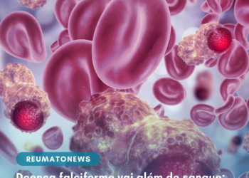Doença falciforme vai além do sangue: feridas nas pernas, dor e AVC podem estar ligados à circulação