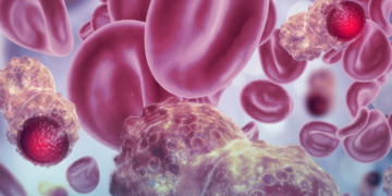 Doença falciforme vai além do sangue: feridas nas pernas, dor e AVC podem estar ligados à circulação