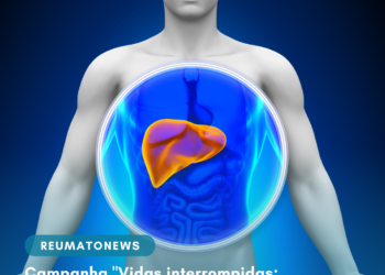 Doença rara Hipofosfatasia (HPP) pode ser confundida com fbromialgia