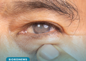 Uso indiscriminado de corticoides pode causar glaucoma e cegueira