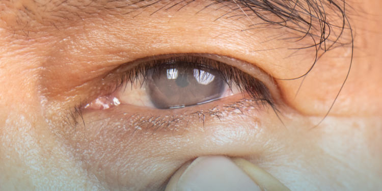 Uso indiscriminado de corticoides pode causar glaucoma e cegueira