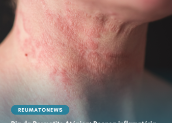 Dia da Dermatite Atópica: Doença inflamatória crônica da pele impacta na qualidade de vida dos pacientes e convívio social