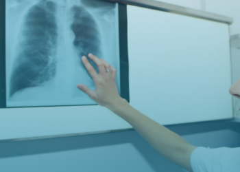 Medicamento que revolucionou o tratamento da hipertensão pulmonar pode entrar no SUS