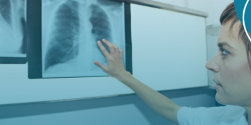 Medicamento que revolucionou o tratamento da hipertensão pulmonar pode entrar no SUS