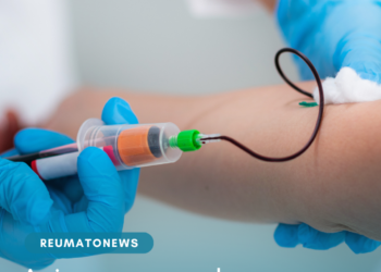 Anvisa aprova exame de sangue para diagnosticar Doença de Alzheimer