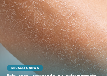 Pele seca, ressecada ou extremamente seca? Saiba identificar as diferenças para cuidar melhor da barreira cutânea