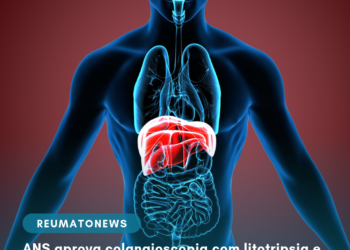 ANS aprova colangioscopia com litotripsia e recomenda preliminarmente não incorporar somatrogona e cabozantinibe.