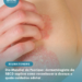 Dia Mundial da Psoríase: dermatologista da SBCD explica como reconhecer a doença e quais cuidados adotar